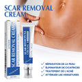 Crème Réparatrice - Acné, Brûlures & Cicatrice